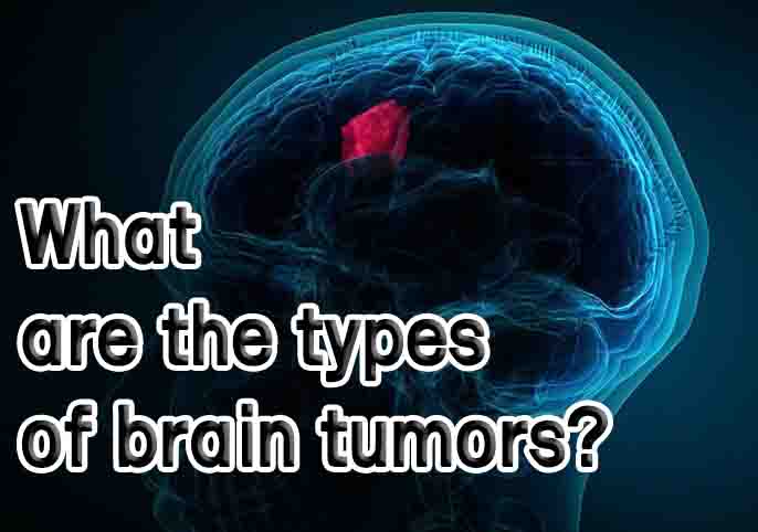 brain tumors